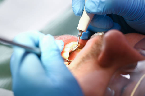 Best Root Canal Emergency Dentist  in Oregon, WI