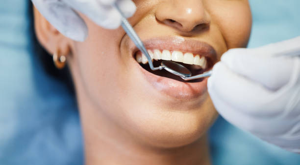 Best Teeth Whitening  in Oregon, WI